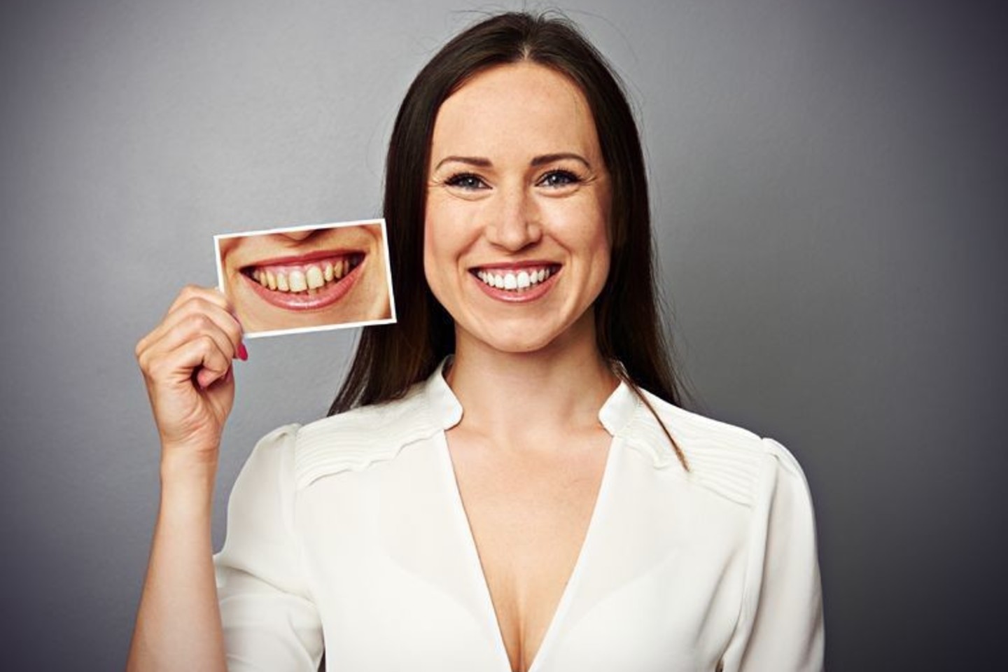 Klijuojamos plokštelės nėra rekomenduojamos turintiems sveikus dantis, tačiau norintiems tiesiog baltesnės šypsenos.<br>123rf nuotr.