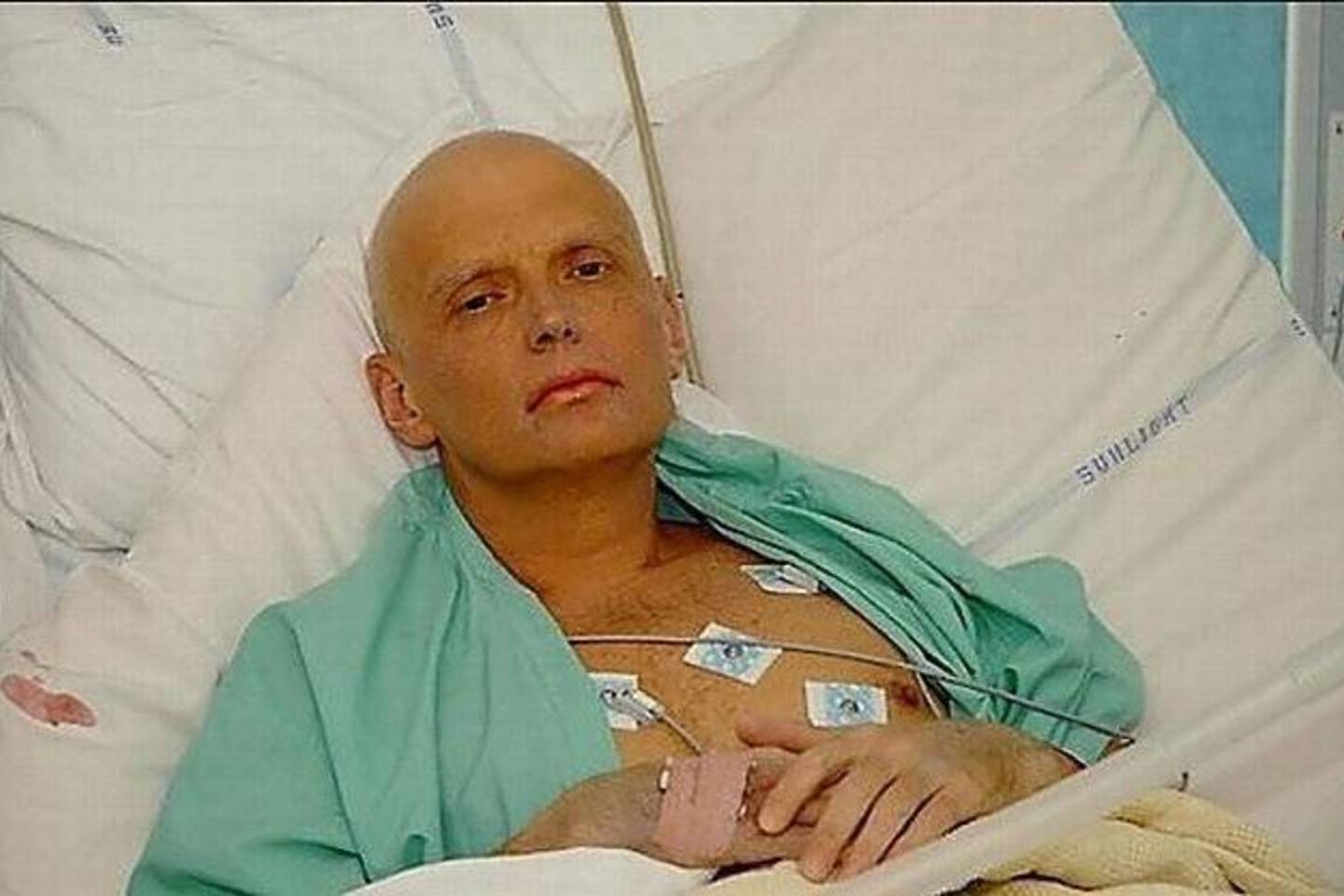 A.Litvinenka, buvęs Rusijos FSB agentas, vėliau tapęs balsingu Kremliaus kritiku, mirė dėl apsinuodijimo radioaktyviu polonio izotopu Po-210.