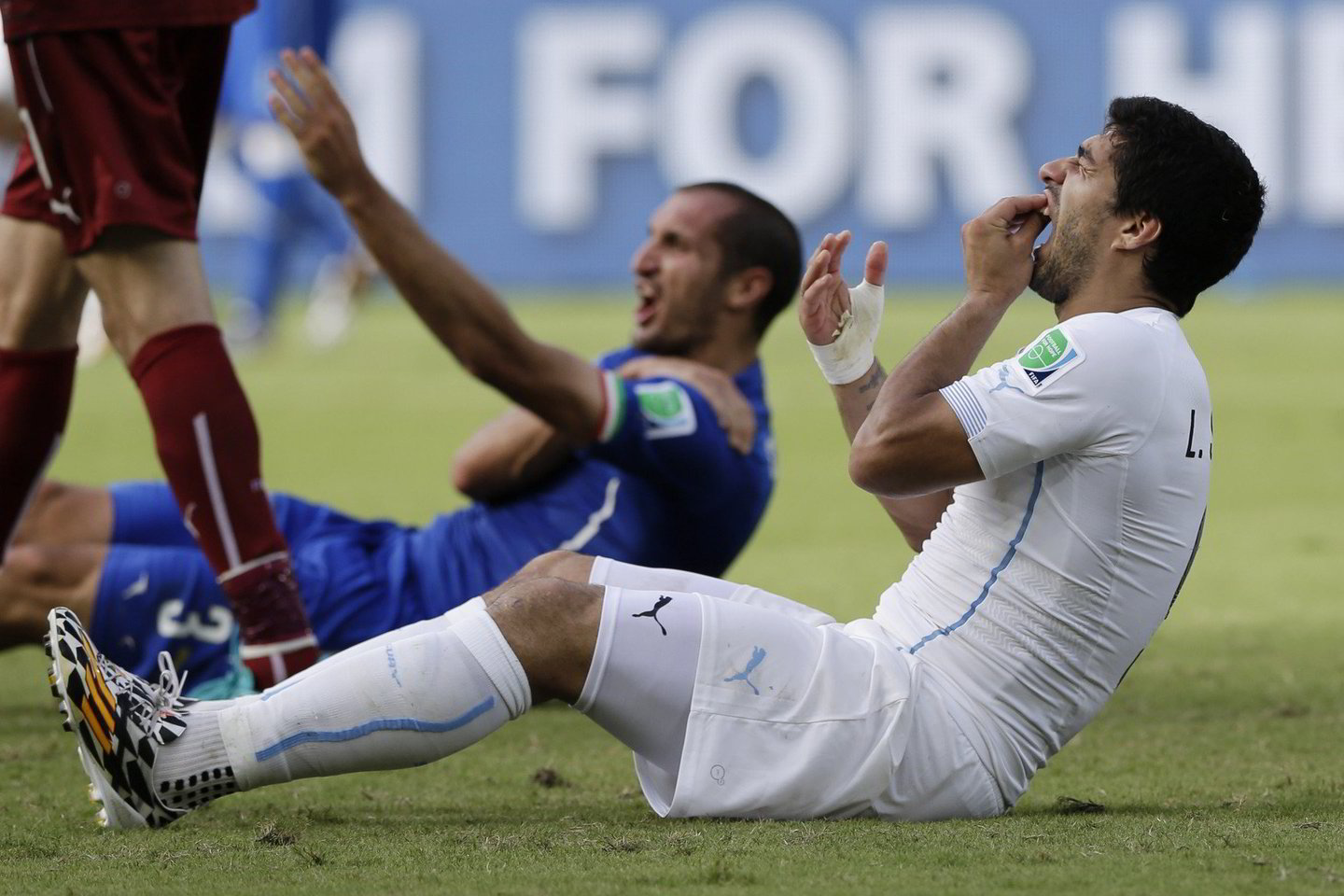 L.Suarezas įkando italui G.Chiellini į petį per pasaulio čempionato rungtynes Brazilijoje.