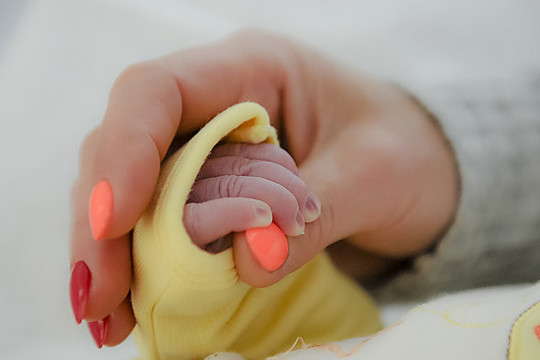 Kūdikių namuose nuplikytos mergaitės gyvybei gresia pavojus