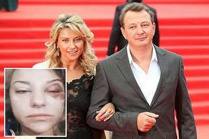 Žmoną neatpažįstamai sumušęs M. Bašarovas: „Labai ją myliu“