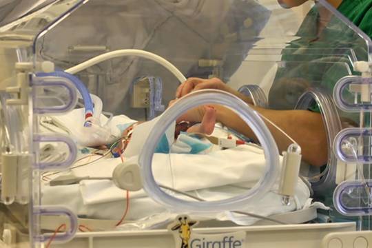 Pusė procento naujagimių Lietuvoje gimsta neišnešioti