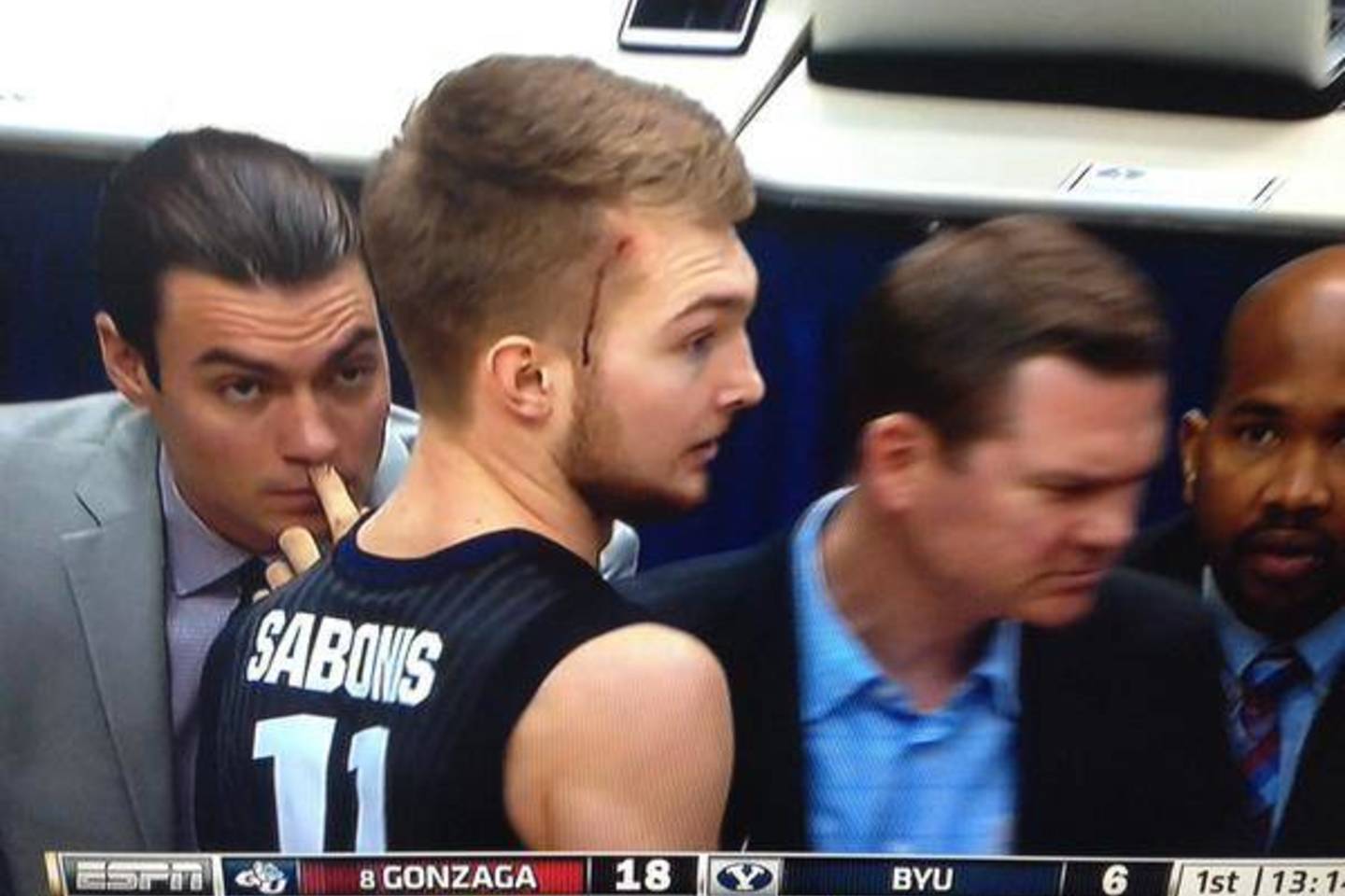 D.Saboniui per NCAA rungtynes buvo prakirstas smilkinys.