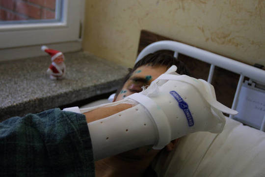 Petardos sužalojo dvylika paauglių