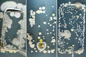 Pamatykite, kokios bakterijų civilizacijos veisiasi ant telefonų