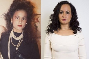 Vengdama raukšlių, moteris nesišypso jau 40 metų