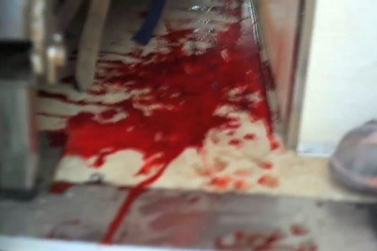 Ukrainos karo medikai paviešino pragariško darbo vaizdus