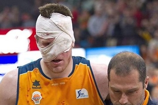 ACB pirmenybėse – viena kruviniausių traumų krepšinio aikštelėje