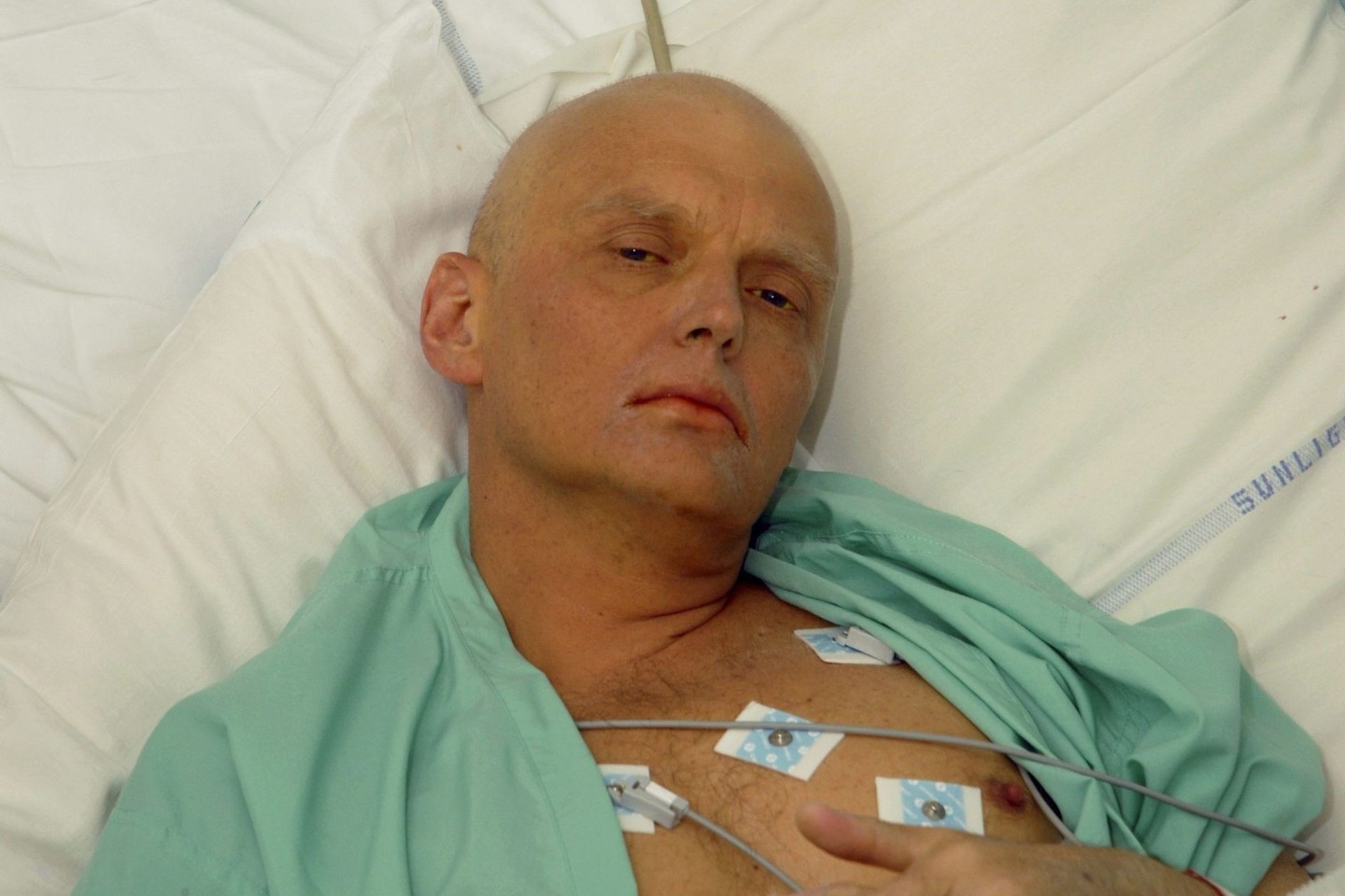 A.Litvinenka 2006 metų lapkritį buvo nunuodytas radioaktyviuoju poloniu.