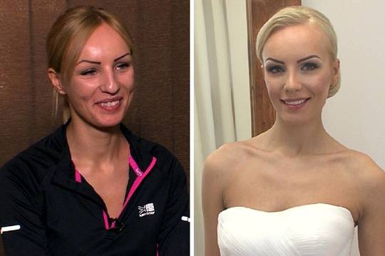 Po operacijų mergina savyje neranda nė vieno trūkumo