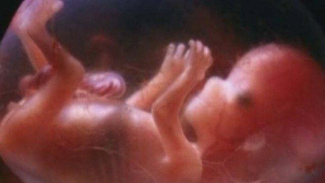 Seime – bandymas slaptai uždrausti abortus?