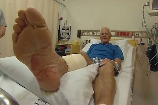 Australą golfo aikštyne užpuolė krokodilas