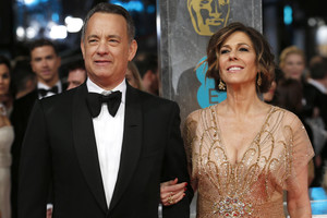 Vėžiu susirgusiai Tomo Hankso žmonai Ritai pašalintos abi krūtys