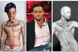 Vyriškiausi vyrai, kuriuos chirurgai sukūrė iš moterų