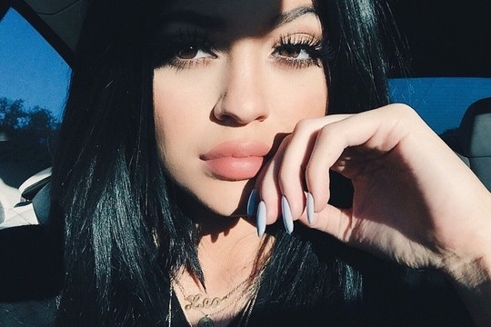 Kylie Jenner lūpų sužavėti paaugliai pradėjo žalojančią madą