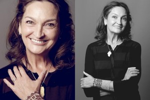 J. Matekonytė: „Vaidyba seriale – lyg vaistai nuo Alzheimerio“