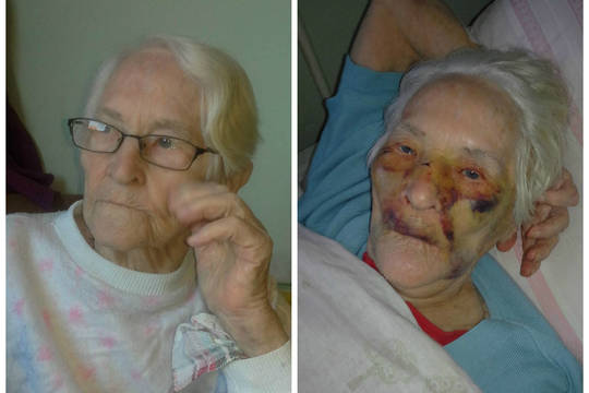 Dukra pašiurpo išvydusi, į ką pavirto motina globos namuose