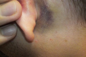 Sumuštą ir sergantį vyrą pribloškė policininko elgesys