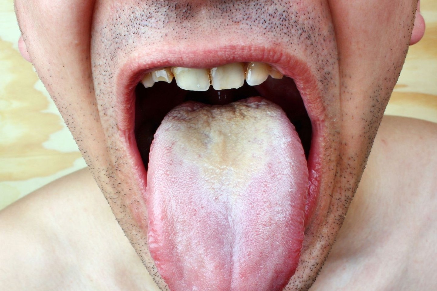 Liežuvio pakitimai gali perspėti apie ligas.<br>123rf nuotr.