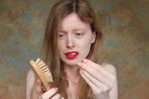 Sauso šampūno pasekmės: šašai, opos ir išplikę plotai