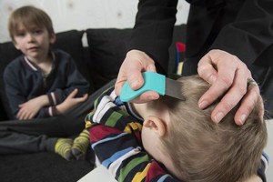 Utėlėti vaikai Lietuvoje – ne tik iš asocialių šeimų