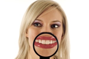 Ar dantų balinimas pažeidžia emalį? 7 svarbūs faktai