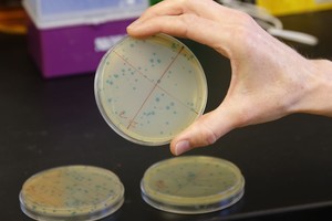 Ateities visraktis nuo ligų – bakterijos?