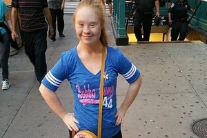 Downo sindromą turinti mergina nustebino visą pasaulį