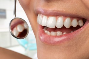 Išrado naują dantų taisymo būdą: be grąžtų, plombų ir skausmo