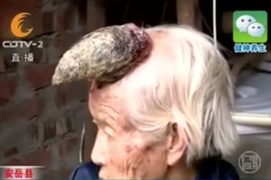 Močiutei ant galvos išaugo didžiulis kietas ragas