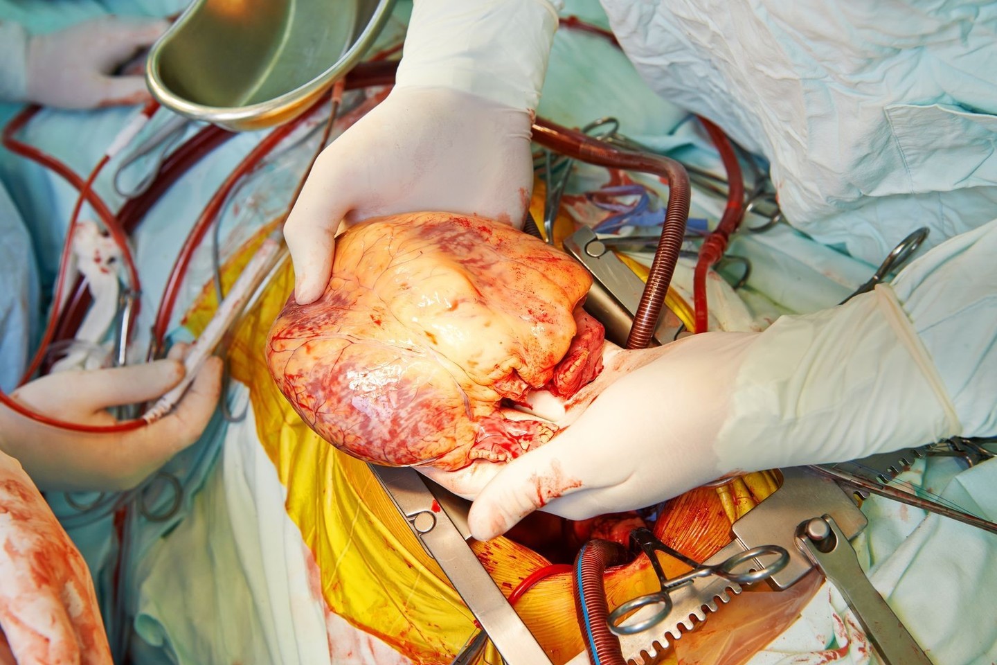Kardiologas atskleidė, ką reiškia rankose laikyti žmogaus širdį.<br>123rf nuotr.
