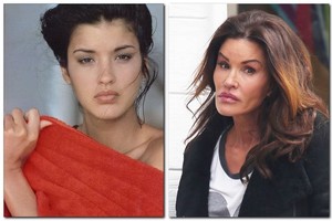 Pirmojo supermodelio grožį subjaurojo plastinė chirurgija