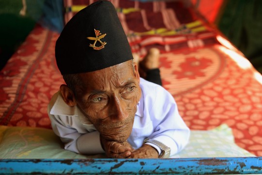 Mirė mažiausias pasaulio žmogus C.Dangi