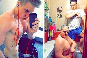 Amputuota koja nesutrukdė atsikratyti pusės kūno svorio