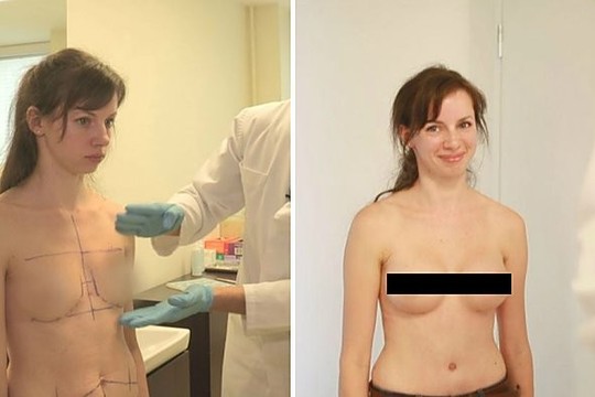 Iš smurto išsilaisvinusi moteris negali patikėti savo sėkme