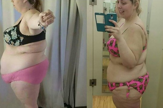 50 kg svorio numetusi moteris internete sulaukė patyčių