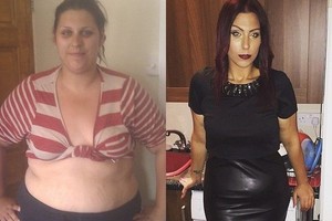 130 kg svėrusiai moteriai sulieknėti padėjo keista priemonė