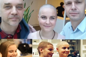 Dėl vėžiu sergančių vaikų plikai nusiskutusi Ieva – ligoninėje