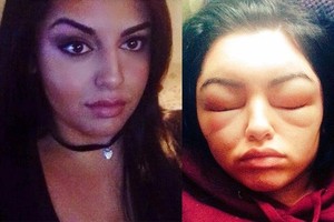 Plaukų dažai pavertė merginą monstru