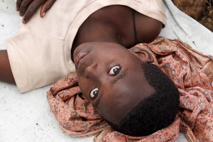 Sirijos medikai būgštauja, kad kils choleros epidemija