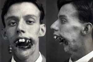 Taip atrodė pirmosios plastinės operacijos