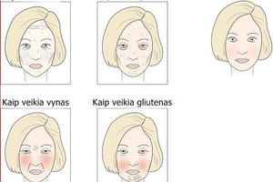 Kokius ženklus veide palieka vynas, cukrus ar pieno produktai?