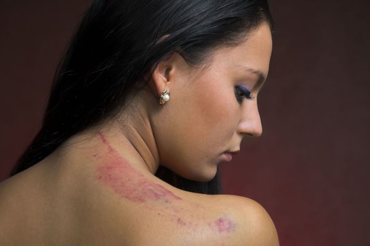 Laisvėje palikto pedofilo dukra išliejo siaubą, kurį patyrė