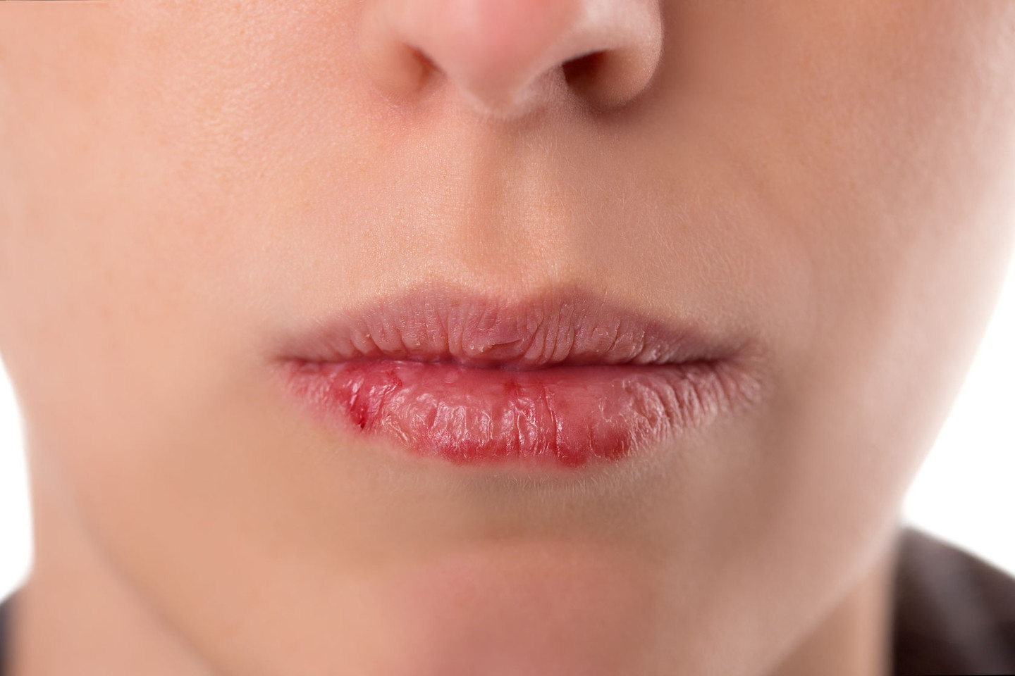 Sausos lūpos reiškia, kad jums trūksta vitaminų.<br>123rf nuotr.