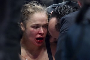 Kruvinos moterų kovos: nokautuota čempionė išgabenta į ligoninę