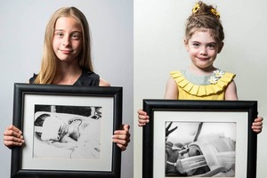 Jaudinanti fotosesija: mirtį įveikę vaikai rodo, kokie buvo