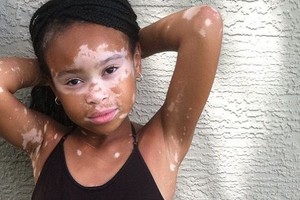 Baltme serganti mergaitė užsimojo įgyvendinti savo svajonę