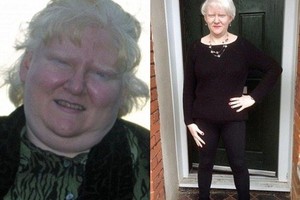 Numesti svorio moterį privertė užklupusios mintys apie mirtį