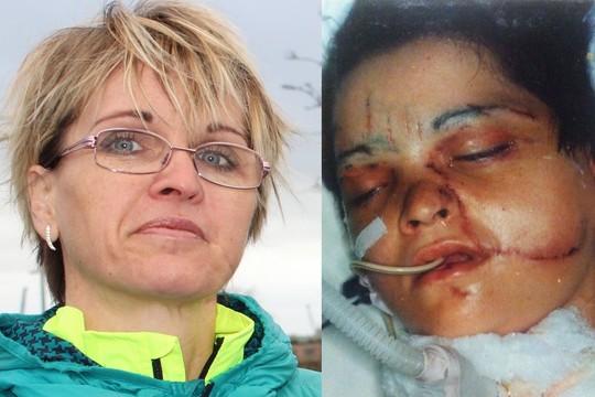 Sportininkė negali patikėti, ką gydytojai jai padarė