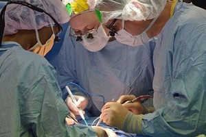 JAV ligoninėje atskirtos vos 7 savaičių siamo dvynės